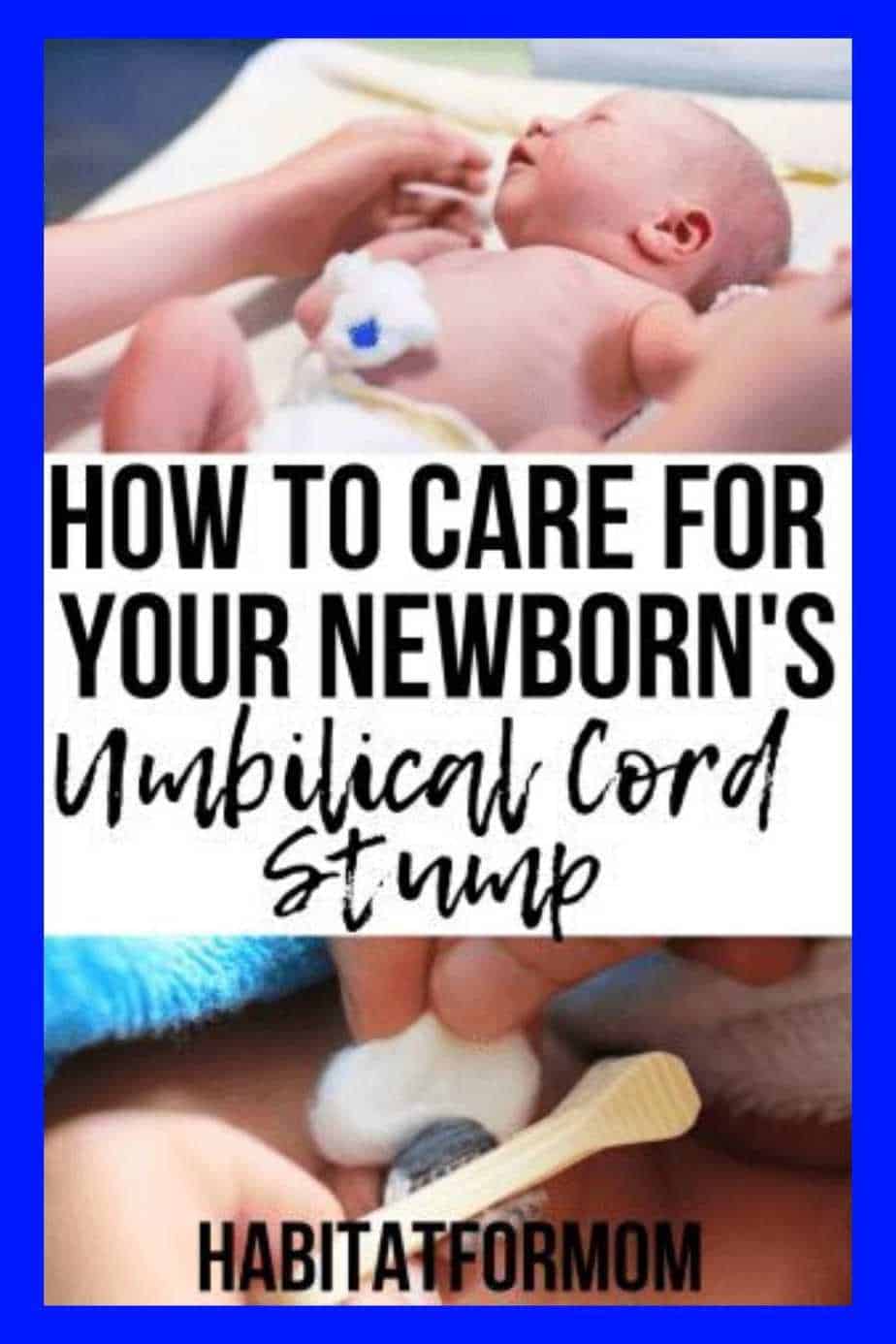 How To Care For Your Newborn’s Umbilical Cord Stump